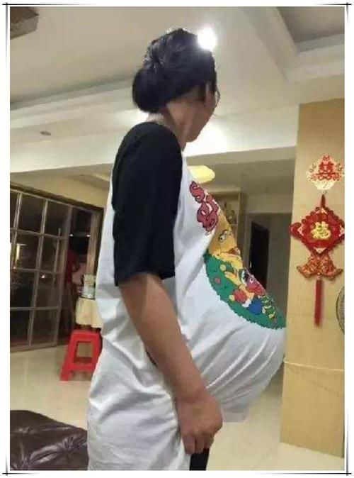 孕妇“悬垂肚”走红，网友猜测是“双胞胎”没见过这样的孕肚