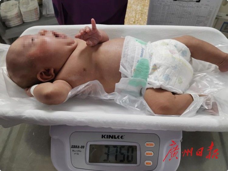凯凯|超早产“巴掌宝宝”，140天生命闯关！看哭了……