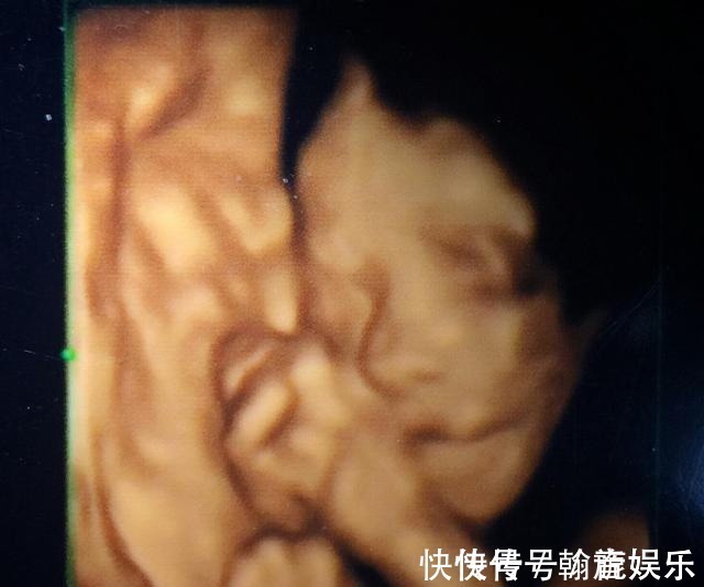 胎儿|孕期要做四维彩超,四维彩超的这些误区和认识,孕妈妈早知道早好