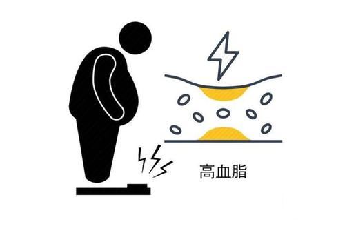 心脑血管疾病|60岁以后，如果这“四种病”都没有，或说明身体比较健康