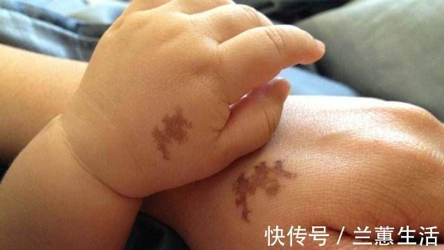 宝妈|怀孕期间准妈妈这样做,会容易在宝宝身上留下“胎记”