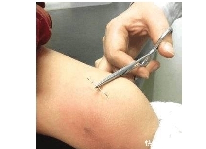 怪异|四岁女童举止怪异,妈妈拉裤子检查,连忙送往医院,医生都懵了