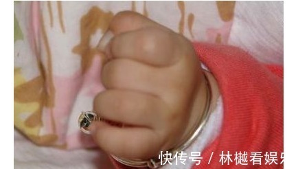孩子|3个月孩子手掌面临截肢，医生取出的东西，宝妈瞬间气的手在抖