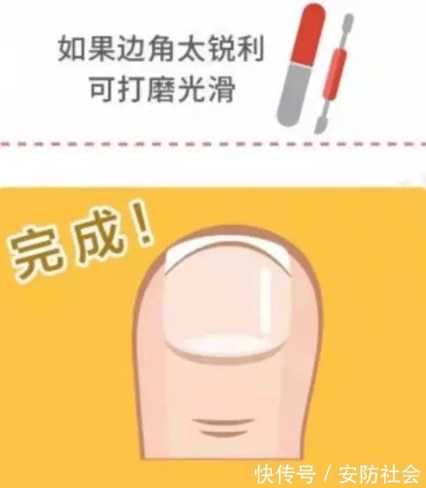 指甲缝|指甲剪不对带来大麻烦,这才是剪指甲的正确方法!