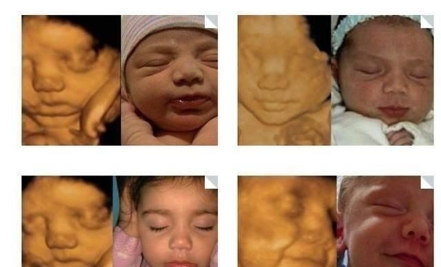 伦琴|做B超前涂的那层黏黏的、凉凉的液体是什么?做完要马上洗掉吗?