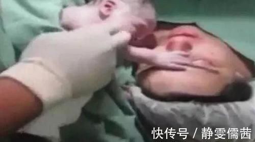 医生|产妇难产心跳停止,婴儿伸手摸妈妈的脸,之后的画面让医生不淡定