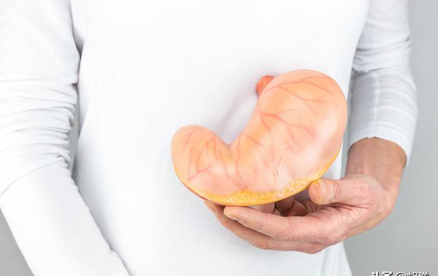 化疗药物|胃癌化疗后三个月去世,做化疗真的会加速病情吗来看看实际情况