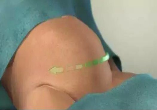 伟大|剖腹产不就是“划肚取胎”组图揭秘全过程，看完才懂母亲的伟大