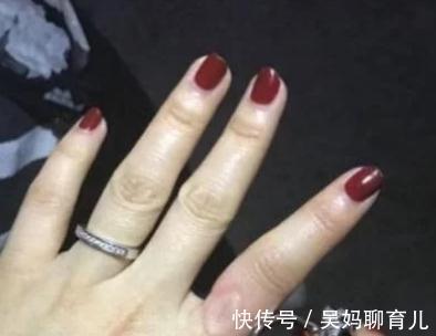 准妈妈|孕期能不能戴首饰?准妈妈不要为了美,做出危害孩子的事情