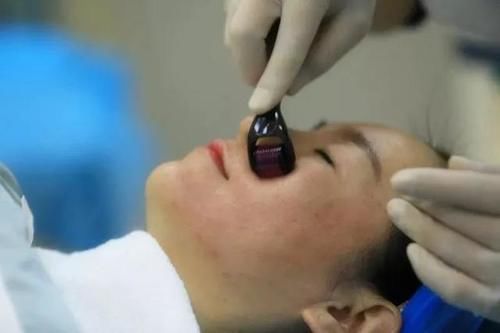 入夏痘痘冒不停？教给你四个真正靠谱的方法