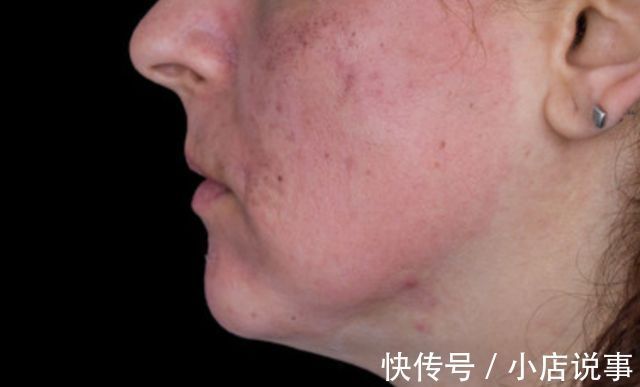 美白|皮肤科专家直言:祛斑美白的4种食物,柠檬排后面,常吃皮肤好