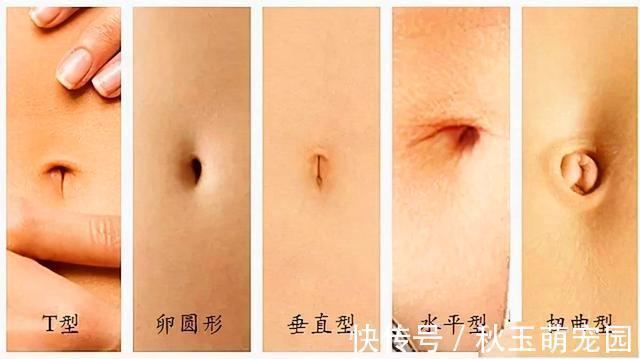 肚子疼!肚脐眼里的“泥”到底是啥?能不能抠?显微镜放大1000倍,真酸爽