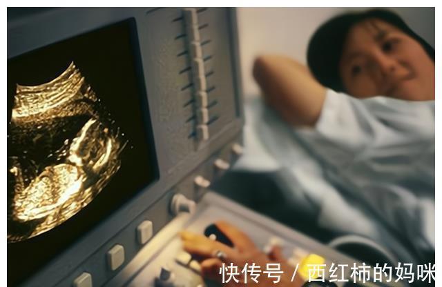 性别|NT检查与胎儿性别有什么关系,孕期NT检查还隐藏着什么?