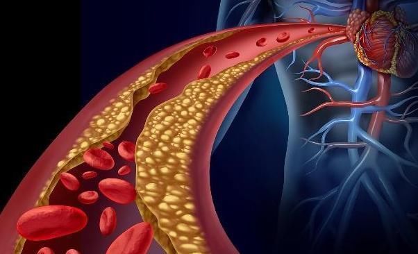 黄芪|一天一杯“黄芪水”,一段时间后,身体会悄悄发生4个“变化”