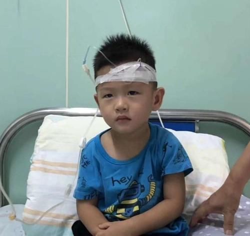 苹果|爱积食的孩子易多病,建议多吃一果,不是苹果,袪积食养好脾