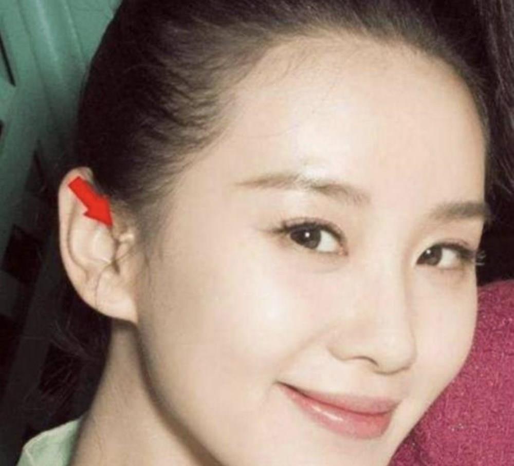 耳边多“肉揪”,孩子理发被嘲笑,耳有“拴马桩”是福气的象征?