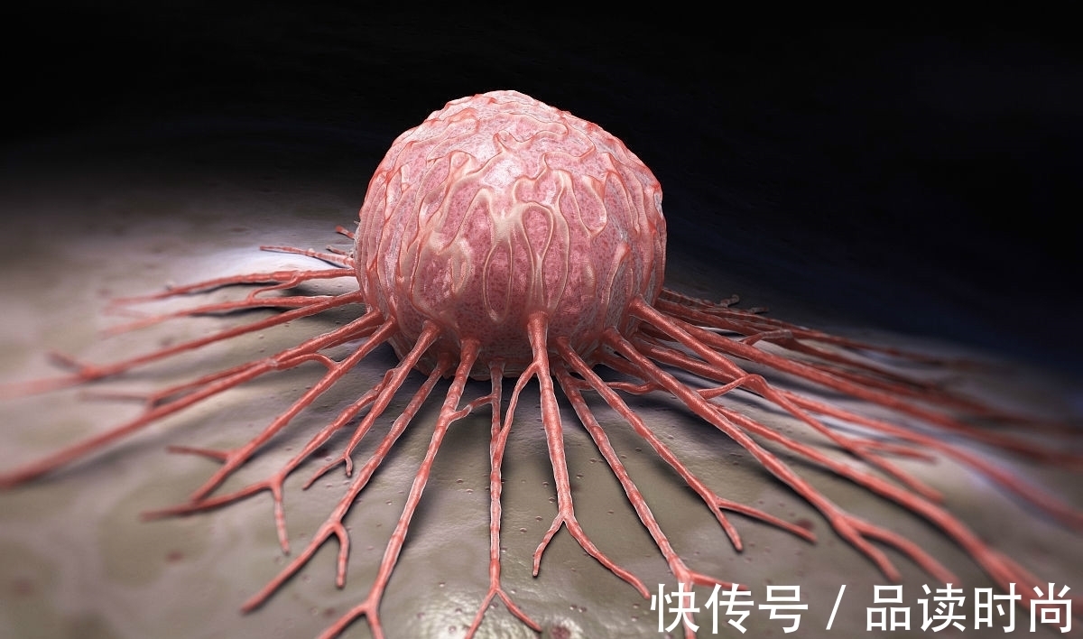 手术|癌症手术切除以后,肿瘤科医生提醒,三种食物,再美味也最好不吃