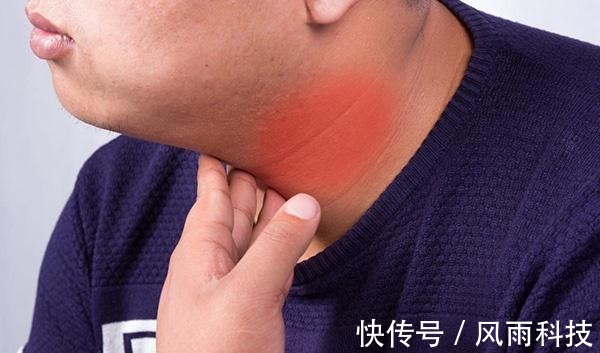 甲状腺|查出甲状腺结节怎么办别慌,多吃三物,结节或许能“不药而愈”