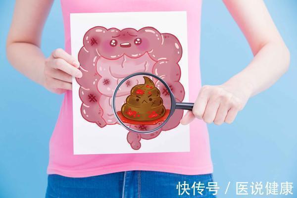 晚期|结肠癌查出多是晚期?医生叮嘱:这4种症状,别再视若无睹了!