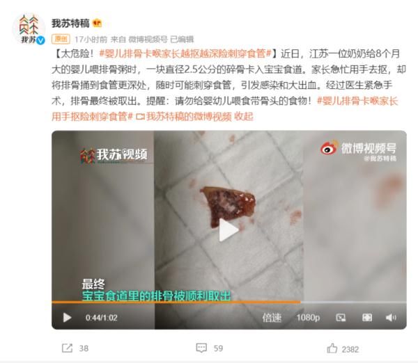 排骨|惊险！婴儿排骨卡喉 家长用手抠险刺穿食管