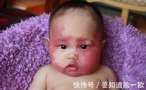 孕妈|怀孕后,一些事情孕妈一定要少做,能够避免胎记的出现