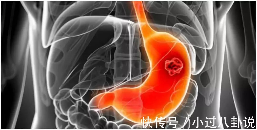 不吃晚饭|坚持不吃晚餐的人,除了体重下降,还为这些疾病埋下伏笔