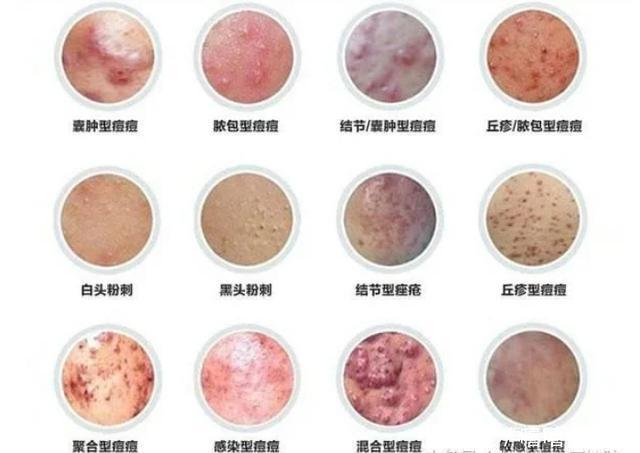 如何保养皮肤才能又白又嫩无私分享15年护肤经验,值得你一看!