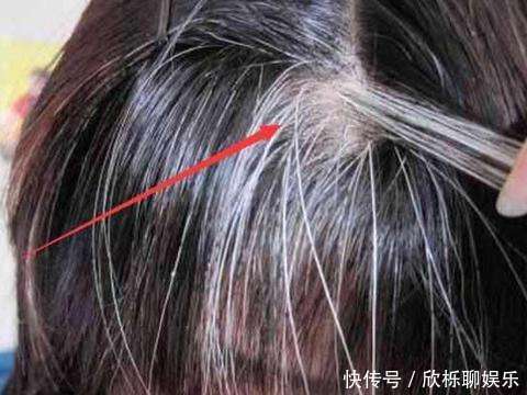 40岁不到,白发乱冒,怎样做才能让白头发来得慢点?