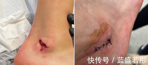 冲击|曼联1-0维拉红魔被动原因可分为二,达洛特你是纯爷们!