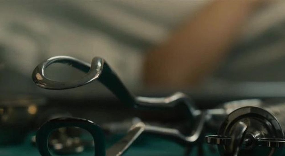 钳印|孩子1岁脸上“产钳印”不消,找医生被反驳,宝妈无言以对