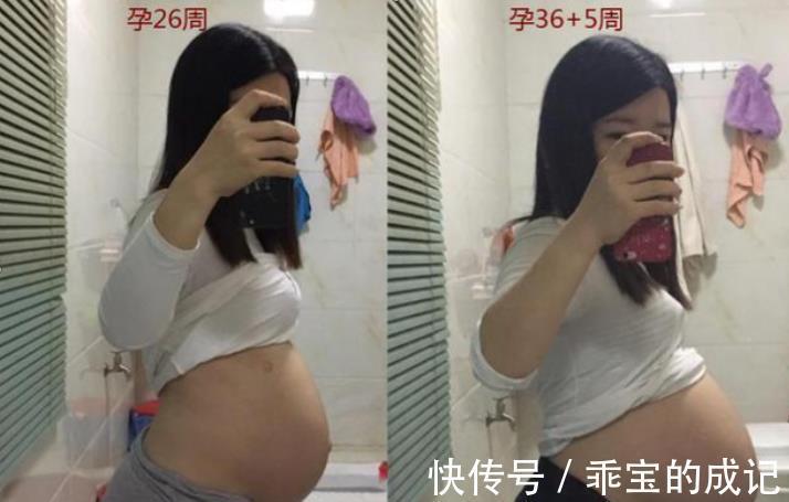 月子病|生娃后有了“妈妈腰”,站着说话也腰疼,原因究竟有哪些?