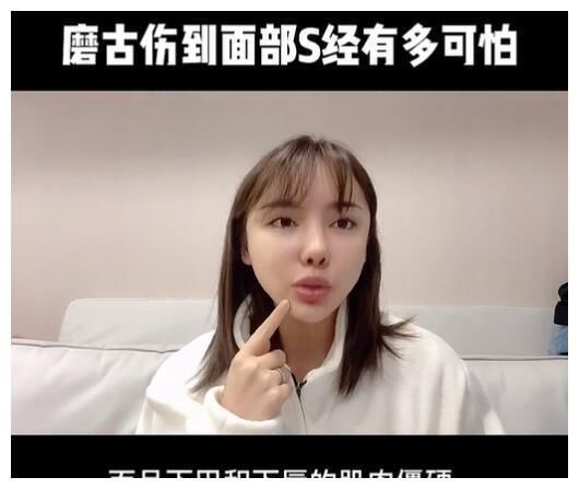 真实颜值|美女网红花70万却整形失败,磨骨伤到神经毁容,自叹非常后悔