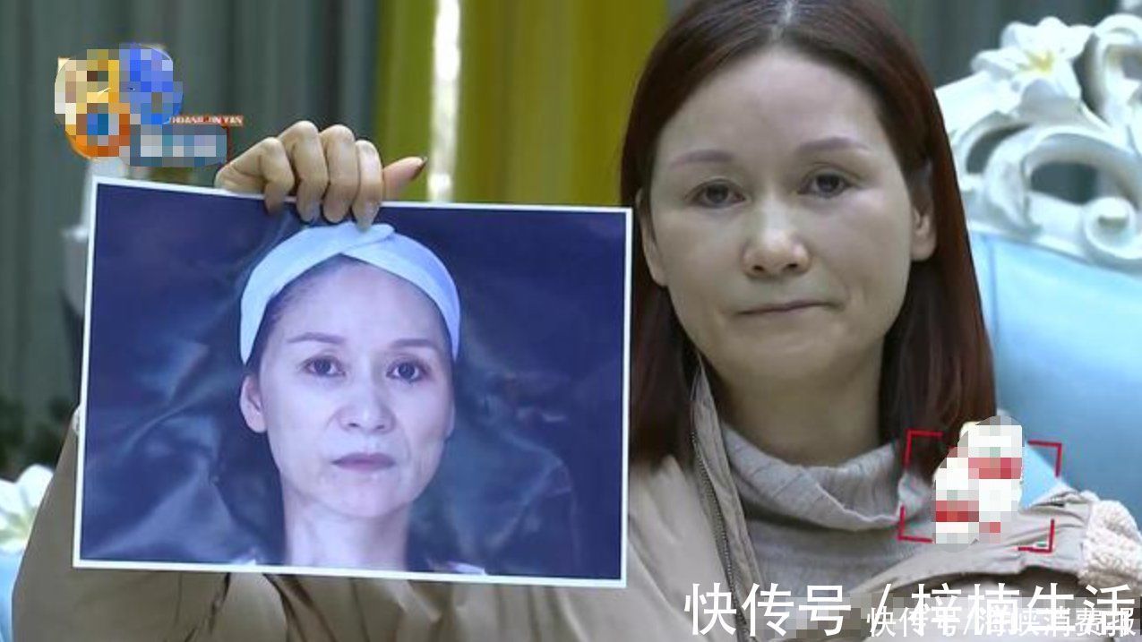 效果|女子13万做医美,觉得效果不好想退款,商家:可以修复不能退款