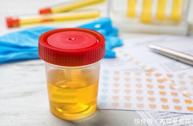 肝不好的人,忌口“三白”,常吃“四绿”,肝一天比一天好