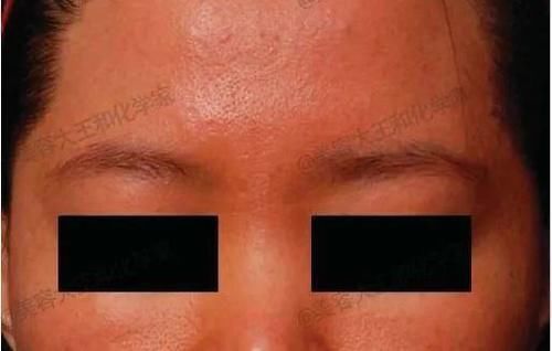 皮肤|你的日常=最强衰老预警难怪你没有姐姐们的逆天状态