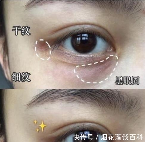 嫌弃|屈臣氏有一“憋屈”眼霜，因价低被嫌弃，用后细纹黑眼圈渐渐消失