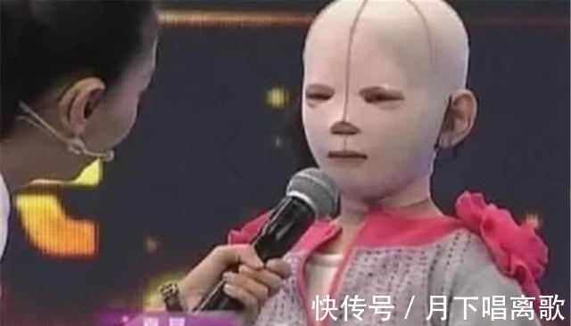 一场车祸，让这位6岁的小女孩戴着头套上学，受尽同学无尽的嘲笑