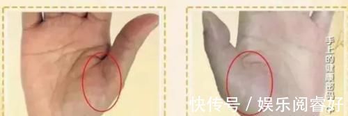 生命线|观手知健康!快速辨识高血压、高血糖就这么看,2分钟学会!