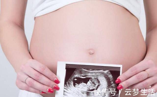 古月|怀孕母亲的肚子大得像双胞胎,但孩子很小,你知道为什么吗