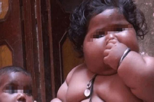 现状|7年了,那个8个月体重45斤,1天吃48顿饭的“巨婴”现状如何