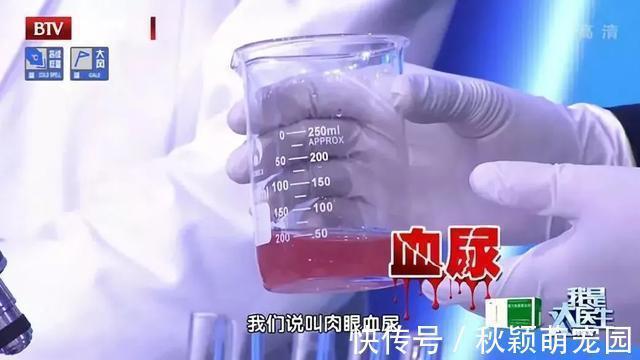 高尿酸|长寿有8个“金标准”！身体健不健康，一看就知道！你达标了吗？