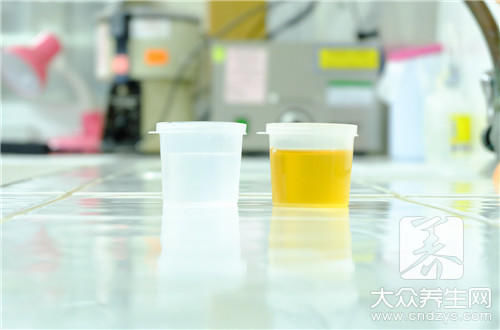  状况|小便总发黄什么原因