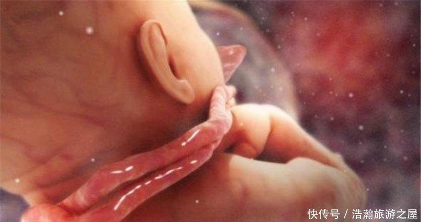 宝妈|孕28周后建议每两周做一次孕检,不是胎儿发育不好,是他太嗨!