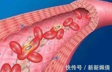 黑豆|血液太稠,担心高血脂,它们被称为血液清洁工,赶走血液里的垃圾