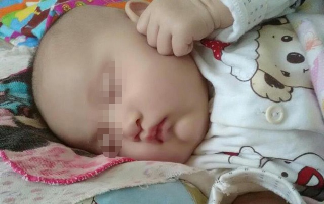 宝妈|宝妈剖腹产下龙凤胎,出产房时却只看到男宝,知道原因后悲痛欲绝