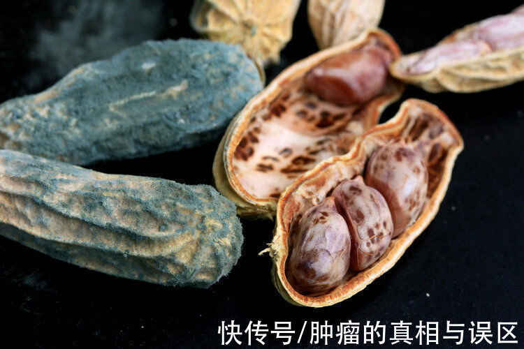 食物|世卫组织公布一级致癌清单:不想招惹癌症,4种食物别轻易下嘴