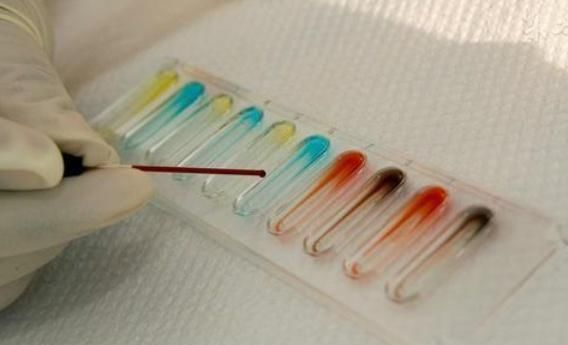 rh阳性血|女人若是这两种血型，第一胎尽量别流掉，可能对你和孩子都好