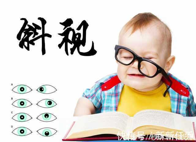 斜视|假性近视、假性斜视?可千万别让它们弄假成真!