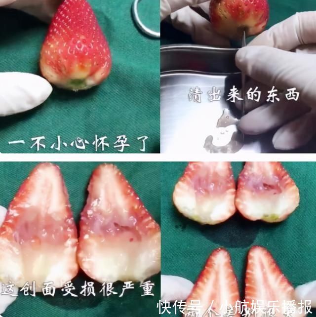 胎宝|头胎是来报恩的?建议“保头胎”不是迷信,产科医生说出原因