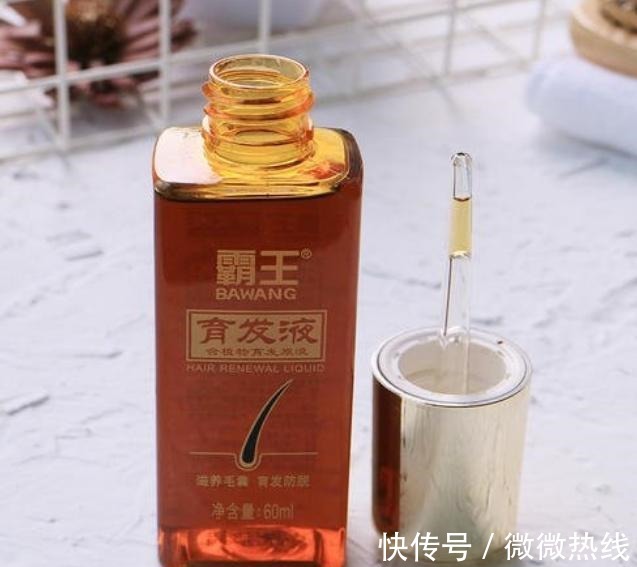 脱发|Tony老师私下透露,发际线“告急”,可能是常年这3种发型引起的!